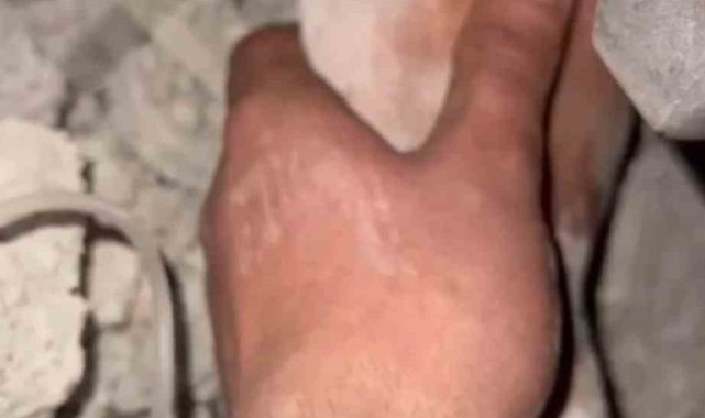 Niğde UMKE ekiplerinden enkaz altındaki vatandaşa hayat eli