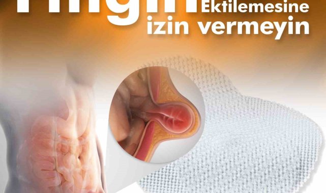 INVAMED'in geliştirdiği CleverMESH cihazı ile fıtık ameliyatı artık daha etkili ve daha uzun ömürlü